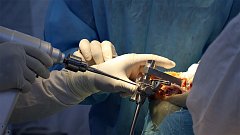 Встать на ноги в Балаково помогают операции на коленных и тазобедренных суставах