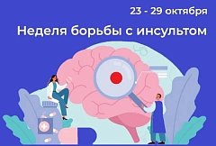 Секреты долгой жизни без риска: 7 шагов против инсульта